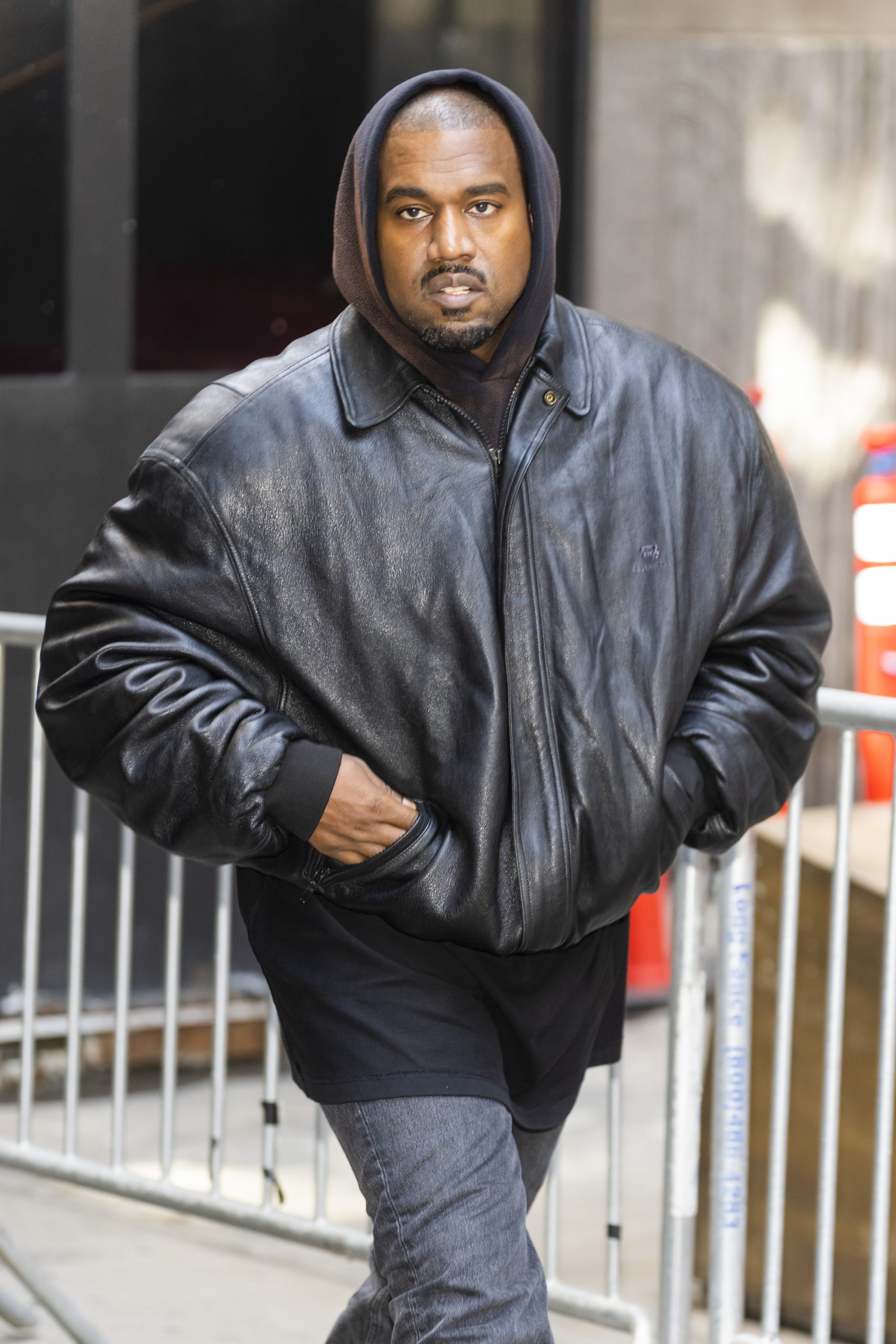 Kanye West’s $850K titanium dentures are ‘fixed and permanent,’ unlike grills or veneers: It’s ‘experimental dentistry’