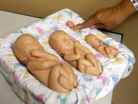 Arizona Court Upholds 1864 Law Banning All Abortions Except to Save Life of the Mother