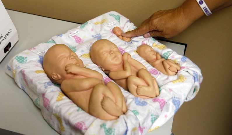 Arizona Court Upholds 1864 Law Banning All Abortions Except to Save Life of the Mother