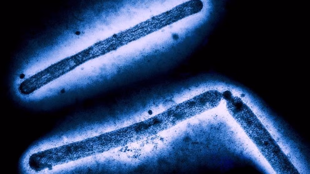 Louisiana Reports First Severe H5N1 Bird Flu Case in U.S., Patient in Critical Condition