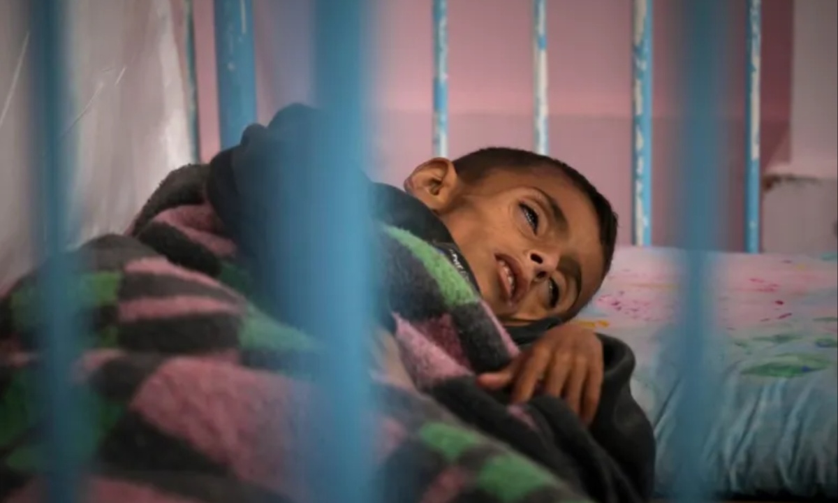 Starvation Grips Gaza as Blockade Starves Children and Collapsing Hospitals Signal Growing Catastrophe